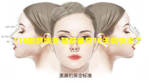 118脂肪填充 脂肪填充10天就快没了